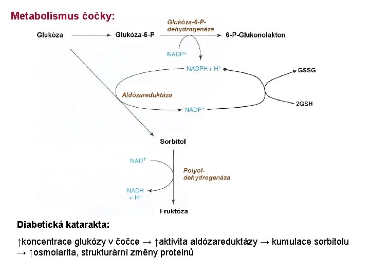 Metabolismus čočky: Diabetická katarakta: ↑koncentrace glukózy v čočce → ↑aktivita aldózareduktázy → kumulace sorbitolu