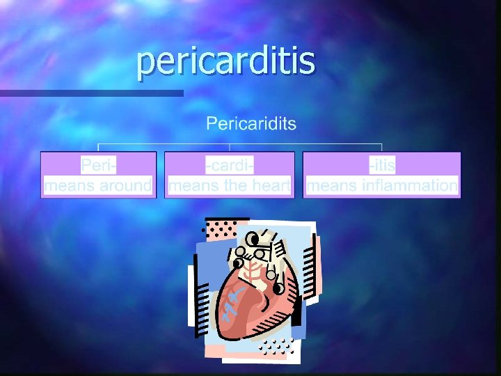 pericarditis 