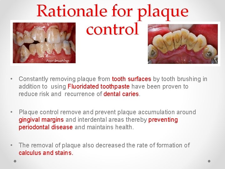 Rationale for plaque control • Constantly removing plaque from tooth surfaces by tooth brushing Rationale for plaque control • Constantly removing plaque from tooth surfaces by tooth brushing