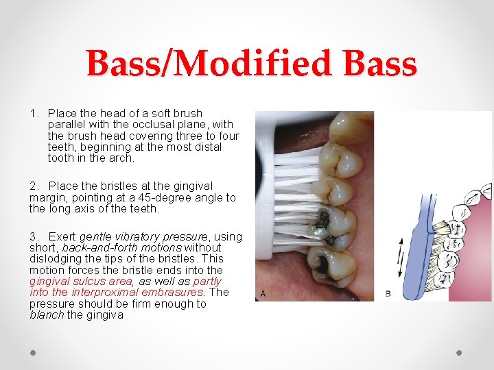Bass/Modified Bass 1. Place the head of a soft brush parallel with the occlusal Bass/Modified Bass 1. Place the head of a soft brush parallel with the occlusal