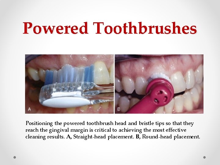 Powered Toothbrushes Positioning the powered toothbrush head and bristle tips so that they reach Powered Toothbrushes Positioning the powered toothbrush head and bristle tips so that they reach