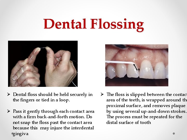Dental Flossing Ø Dental floss should be held securely in the fingers or tied Dental Flossing Ø Dental floss should be held securely in the fingers or tied