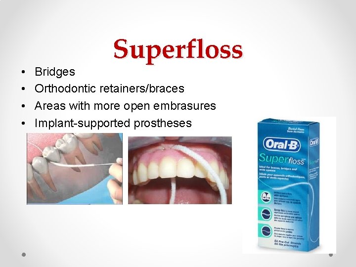 • • Superfloss Bridges Orthodontic retainers/braces Areas with more open embrasures Implant-supported prostheses • • Superfloss Bridges Orthodontic retainers/braces Areas with more open embrasures Implant-supported prostheses