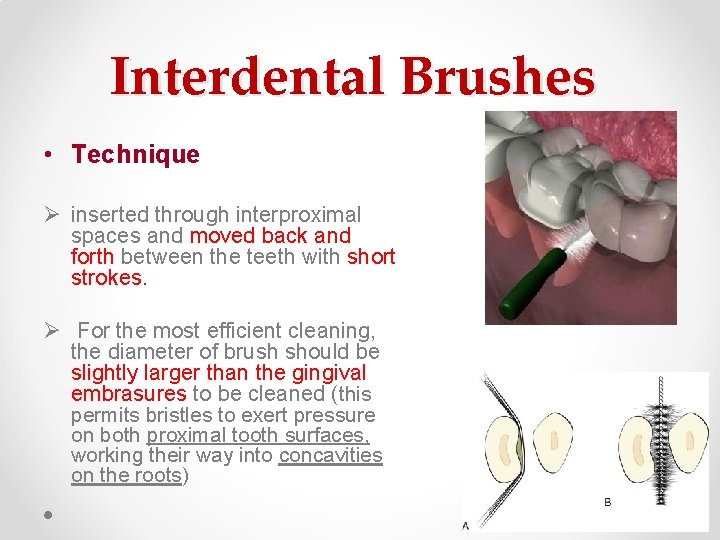 Interdental Brushes • Technique Ø inserted through interproximal spaces and moved back and forth Interdental Brushes • Technique Ø inserted through interproximal spaces and moved back and forth