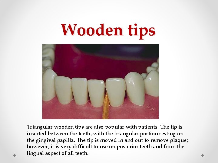 Wooden tips Triangular wooden tips are also popular with patients. The tip is inserted Wooden tips Triangular wooden tips are also popular with patients. The tip is inserted
