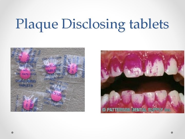 Plaque Disclosing tablets Plaque Disclosing tablets
