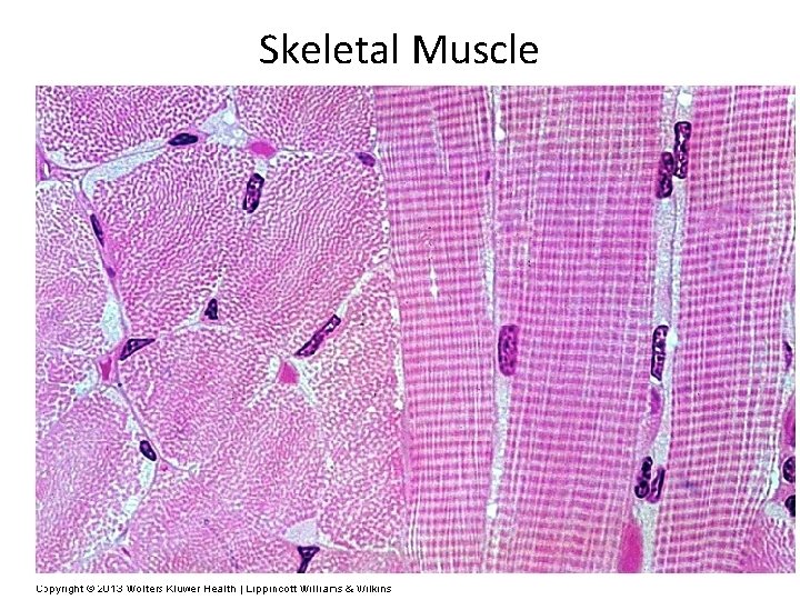 Skeletal Muscle 