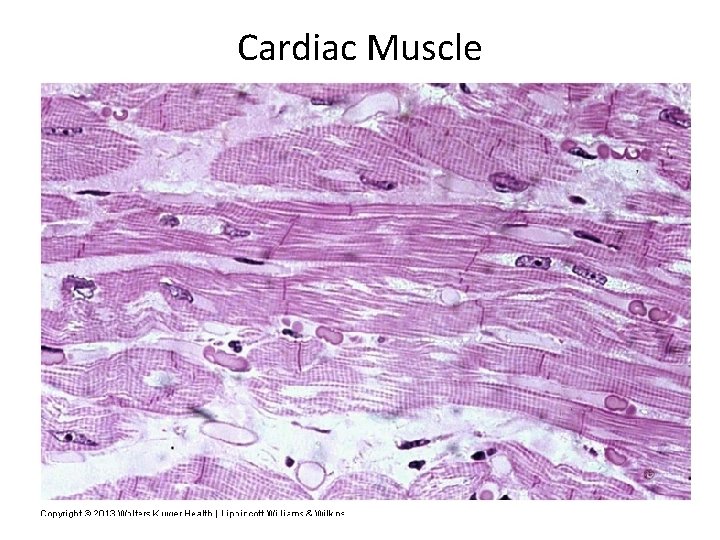 Cardiac Muscle 