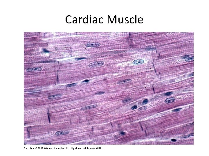 Cardiac Muscle 