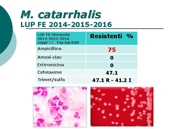 M. catarrhalis LUP FE 2014 -2015 -2016 LUP FE Moraxella 2014 -2015 -2016 ceppi