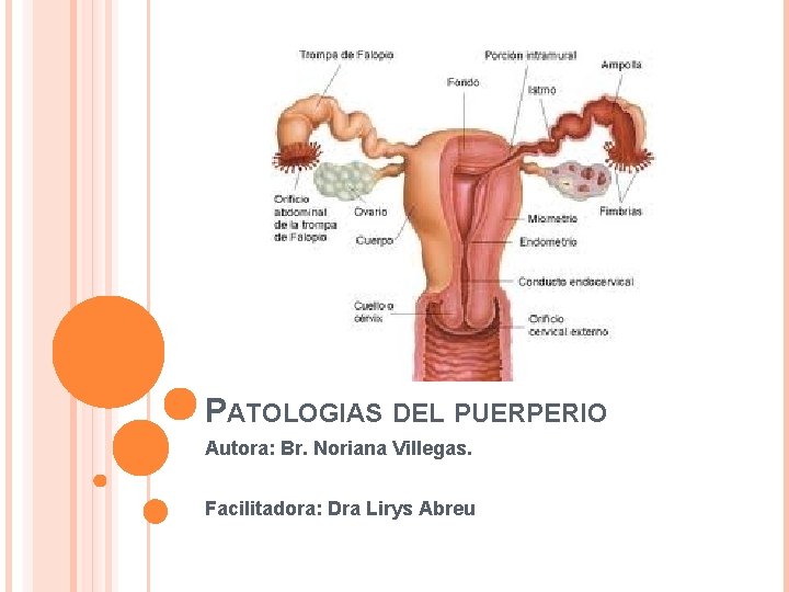 PATOLOGIAS DEL PUERPERIO Autora: Br. Noriana Villegas. Facilitadora: Dra Lirys Abreu 