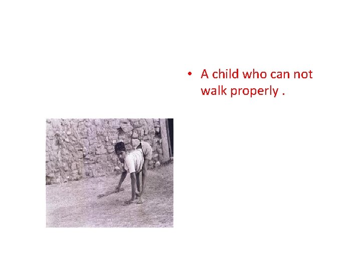  • A child who can not walk properly. 