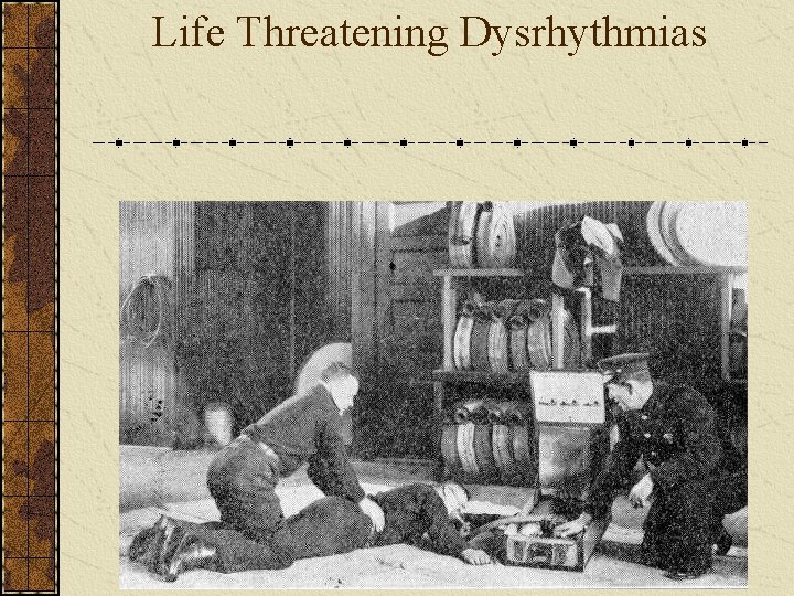 Life Threatening Dysrhythmias 