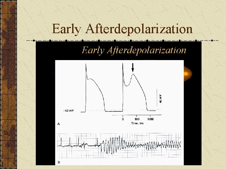 Early Afterdepolarization 