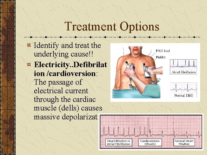 Treatment Options Identify and treat the underlying cause!! Electricity. . Defibrilat ion /cardioversion: The