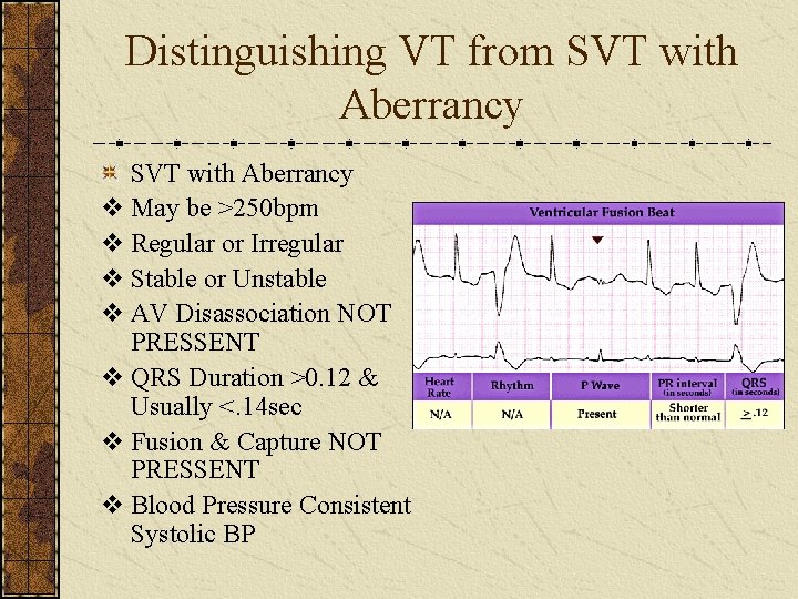 Distinguishing VT from SVT with Aberrancy v May be >250 bpm v Regular or