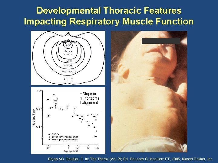 Developmental Thoracic Features Impacting Respiratory Muscle Function * Slope of 1=horizonta l alignment Bryan