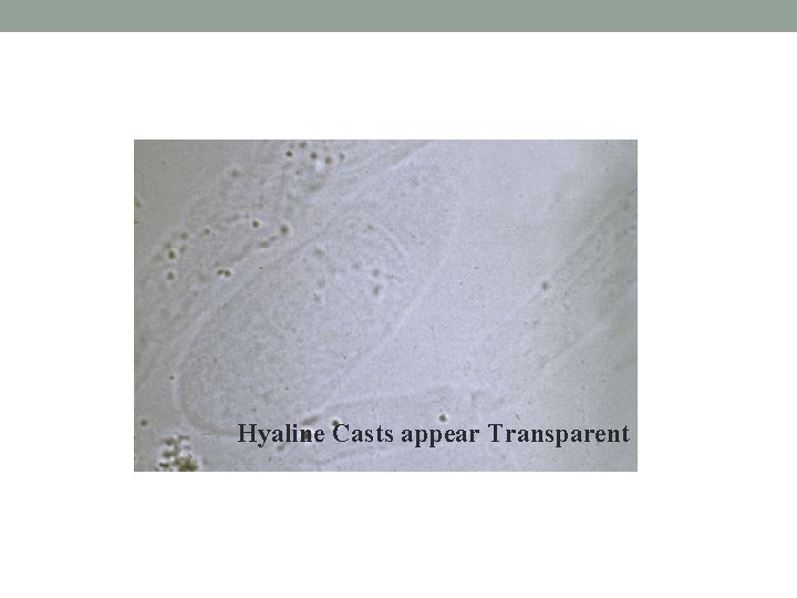 Hyaline Casts appear Transparent 