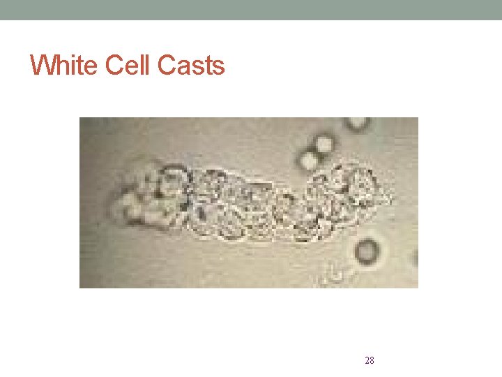 White Cell Casts 28 
