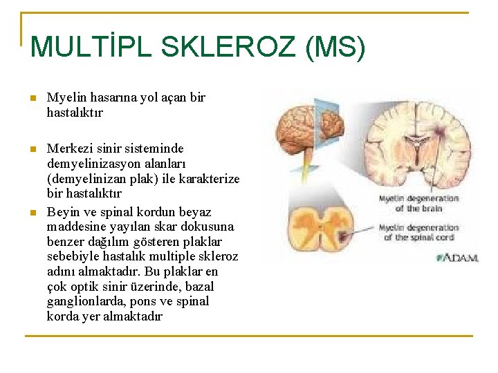 MULTİPL SKLEROZ (MS) n Myelin hasarına yol açan bir hastalıktır n Merkezi sinir sisteminde