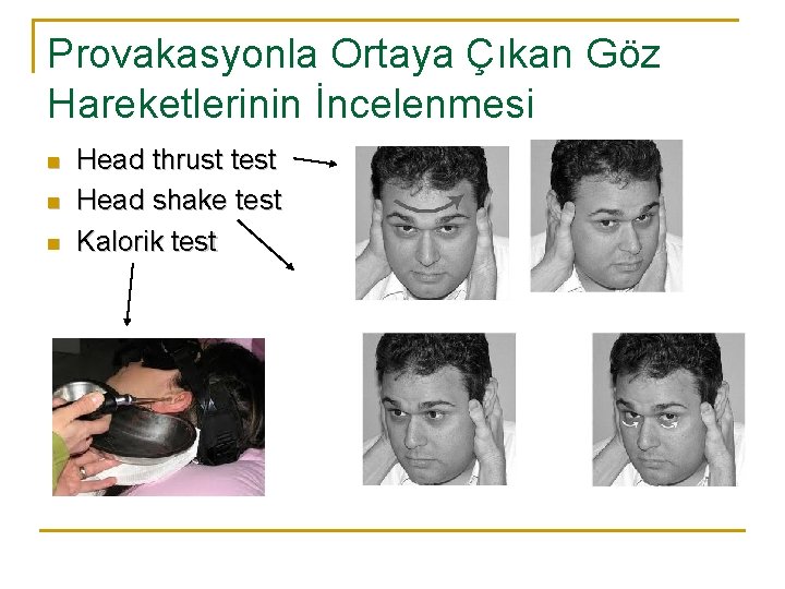 Provakasyonla Ortaya Çıkan Göz Hareketlerinin İncelenmesi n n n Head thrust test Head shake