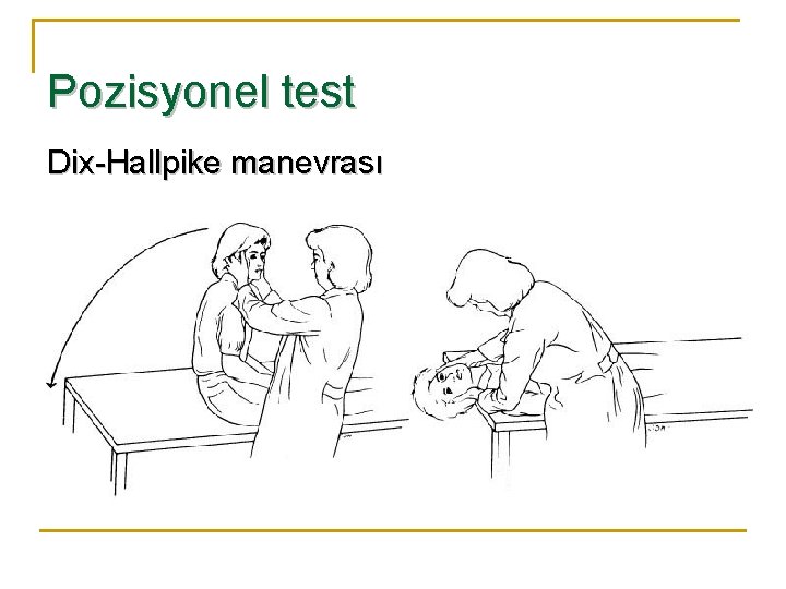 Pozisyonel test Dix-Hallpike manevrası 