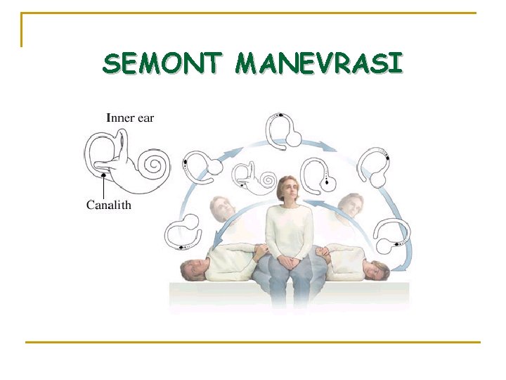 SEMONT MANEVRASI 