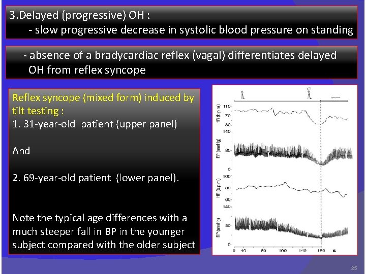 3. Delayed (progressive) OH : - slow progressive decrease in systolic blood pressure on