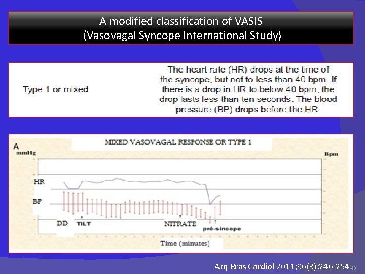 A modified classification of VASIS (Vasovagal Syncope International Study) Arq Bras Cardiol 2011; 96(3):