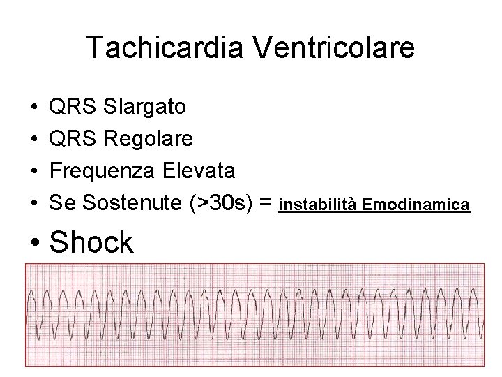 Tachicardia Ventricolare • • QRS Slargato QRS Regolare Frequenza Elevata Se Sostenute (>30 s)