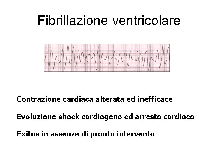 Fibrillazione ventricolare Contrazione cardiaca alterata ed inefficace Evoluzione shock cardiogeno ed arresto cardiaco Exitus