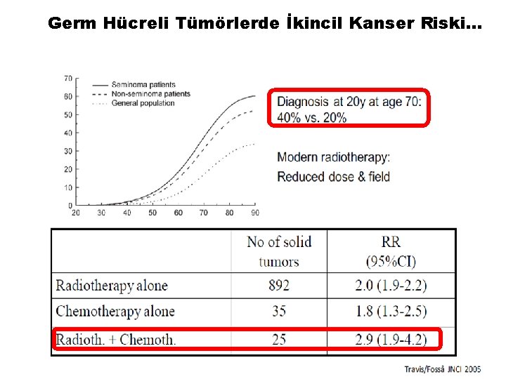 Germ Hücreli Tümörlerde İkincil Kanser Riski… 