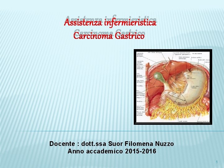 Assistenza infermieristica Carcinoma Gastrico Docente : dott. ssa Suor Filomena Nuzzo Anno accademico 2015