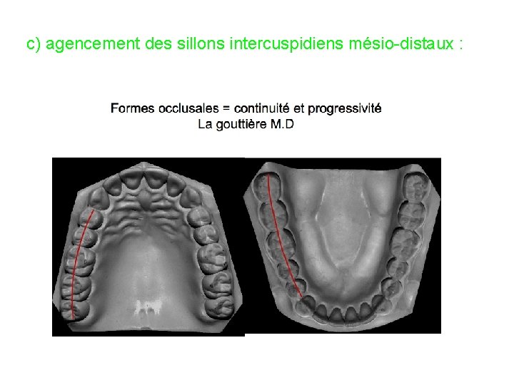 c) agencement des sillons intercuspidiens mésio-distaux : 