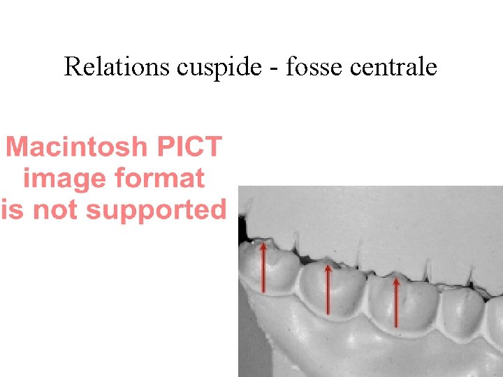 Relations cuspide - fosse centrale 