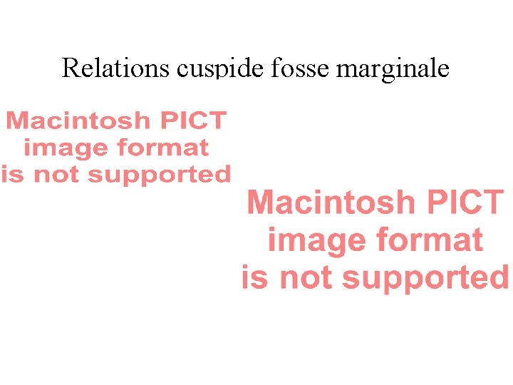 Relations cuspide fosse marginale 