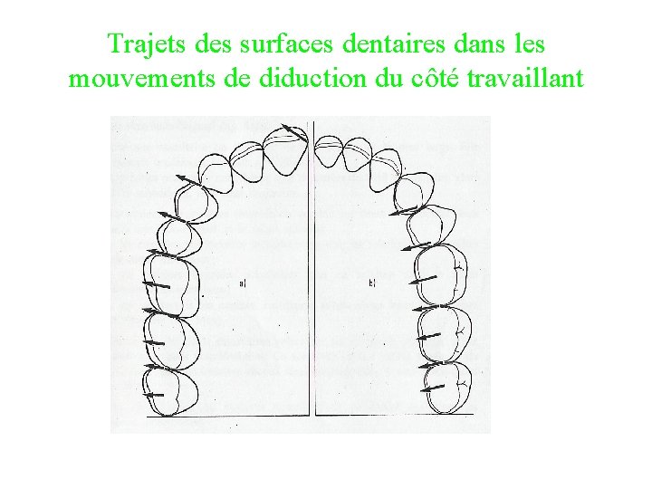 Trajets des surfaces dentaires dans les mouvements de diduction du côté travaillant 