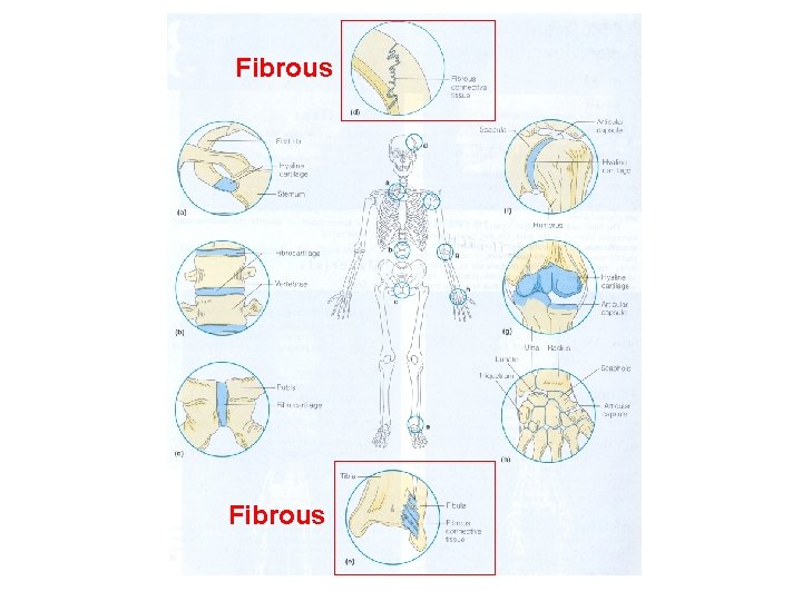 Fibrous Fibrous