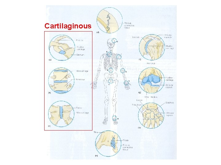 Cartilaginous Cartilaginous