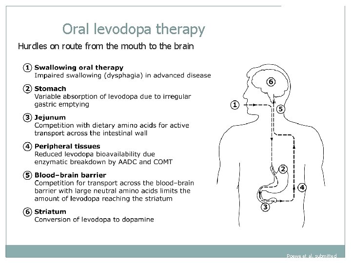 Oral levodopa therapy Hurdles on route from the mouth to the brain Poewe et