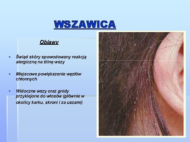 WSZAWICA Objawy § Świąd skóry spowodowany reakcją alergiczną na ślinę wszy § Miejscowe powiększenie