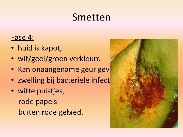 Smetten Fase 4: • huid is kapot, • wit/geel/groen verkleurd • Kan onaangename geur