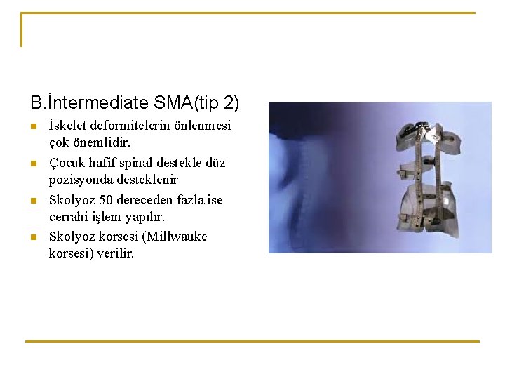 B. İntermediate SMA(tip 2) n n İskelet deformitelerin önlenmesi çok önemlidir. Çocuk hafif spinal