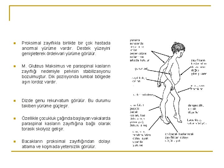 n Proksimal zayıflıkla birlikte bir çok hastada anormal yürüme vardır. Destek yüzeyini genişleterek ördekvari