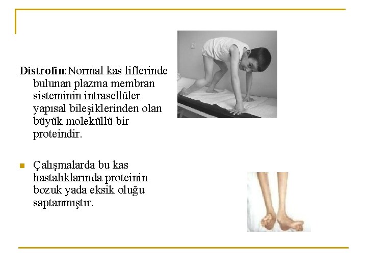 Distrofin: Normal kas liflerinde bulunan plazma membran sisteminin intrasellüler yapısal bileşiklerinden olan büyük moleküllü