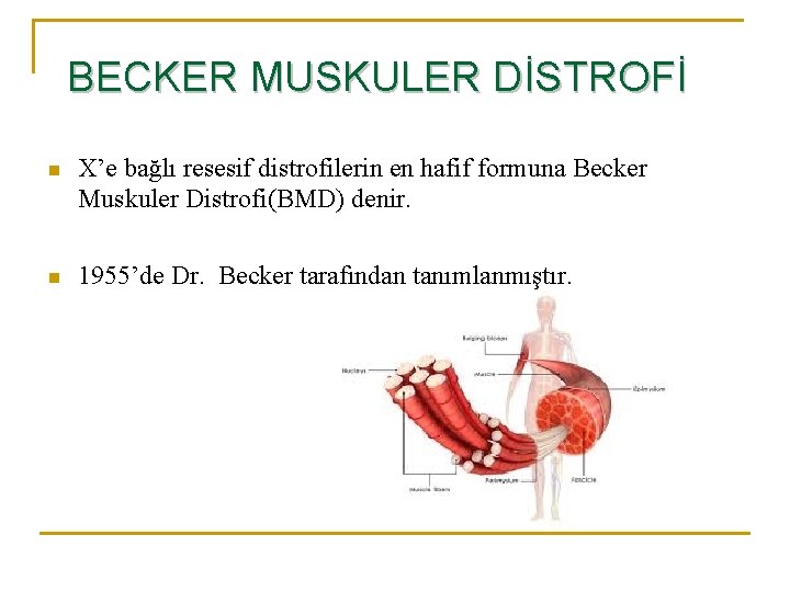BECKER MUSKULER DİSTROFİ n X’e bağlı resesif distrofilerin en hafif formuna Becker Muskuler Distrofi(BMD)