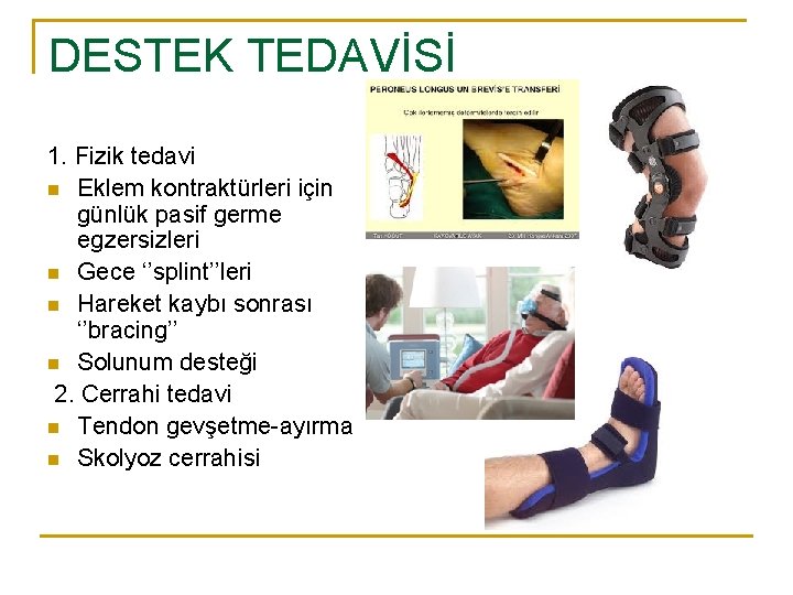 DESTEK TEDAVİSİ 1. Fizik tedavi n Eklem kontraktürleri için günlük pasif germe egzersizleri n