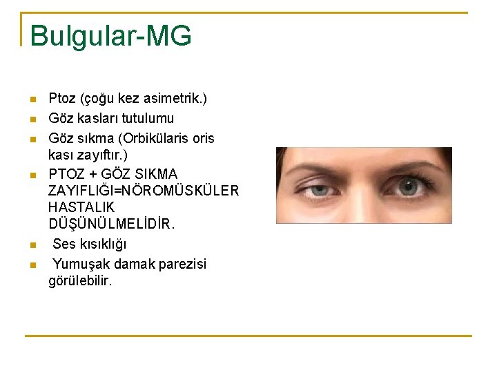 Bulgular-MG n n n Ptoz (çoğu kez asimetrik. ) Göz kasları tutulumu Göz sıkma