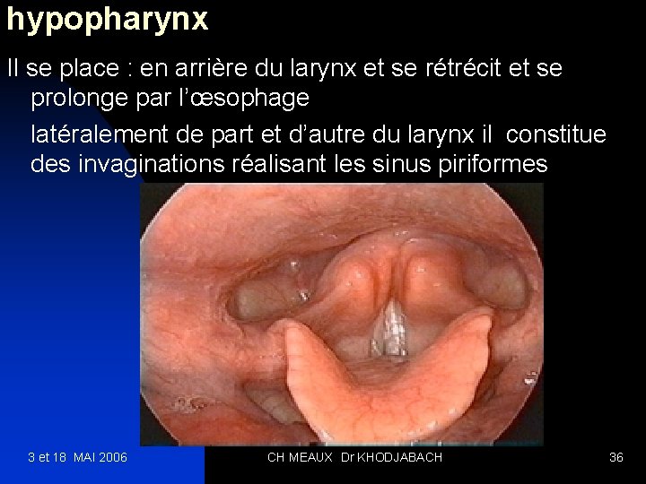 hypopharynx Il se place : en arrière du larynx et se rétrécit et se