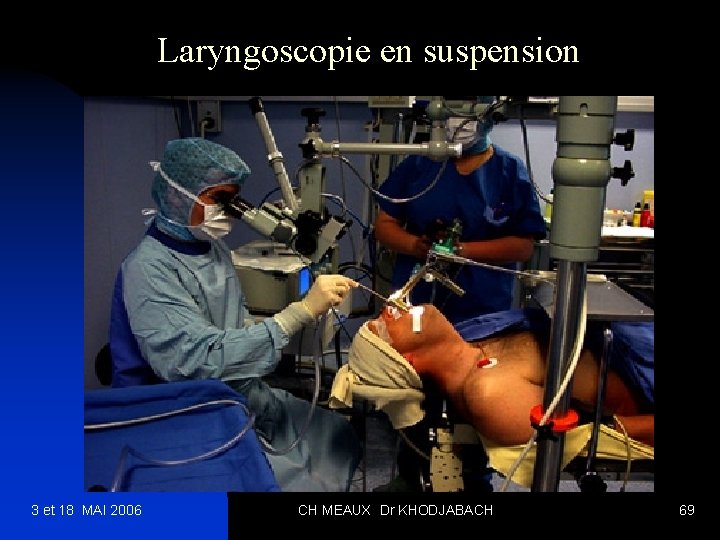 Laryngoscopie en suspension 3 et 18 MAI 2006 CH MEAUX Dr KHODJABACH 69 